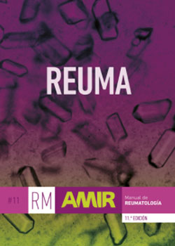 Reuma