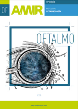 oftalmo